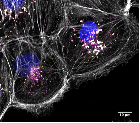Human Kidney 2 cell showing actin assemblies Human Kidney 2 cell showing actin assemblies
