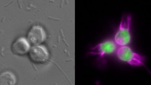 The choanoflagellate Salpingoeca rosetta expressing fluorescent proteins illuminating the cell body (green) and the plasma membrane (magenta)