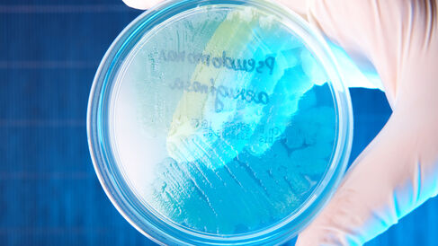 Pseudomonas aeruginosa culture.