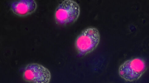 Immunofluorescence microscopy of Amphidinium carterae showing the expression of an artificially introduced gene.