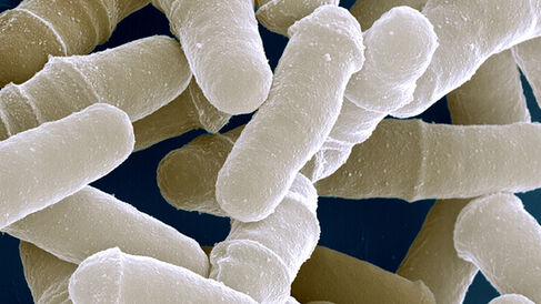 Scanning electron micrograph of an S.pombe culture