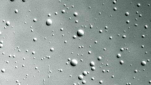 Phase-separated dense liquid droplets formed from histone H1 C-terminal tail/DNA complexes, viewed under a microscope.
