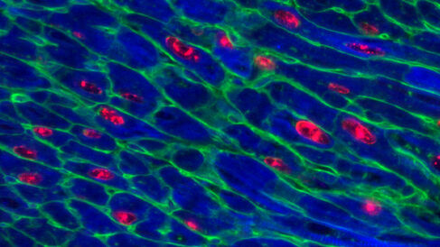 Adult mouse heart 48 hours after activation of Myc together with Ccnt1 expression.