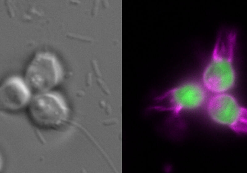 The choanoflagellate Salpingoeca rosetta expressing fluorescent proteins illuminating the cell body (green) and the plasma membrane (magenta)