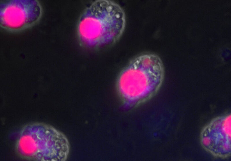 Immunofluorescence microscopy of Amphidinium carterae showing the expression of an artificially introduced gene.