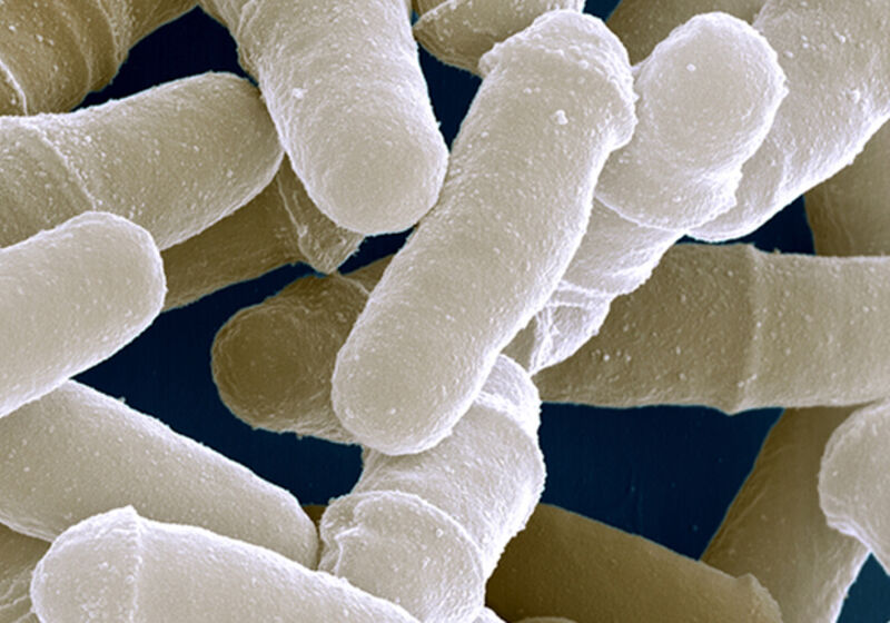 Scanning electron micrograph of an S.pombe culture