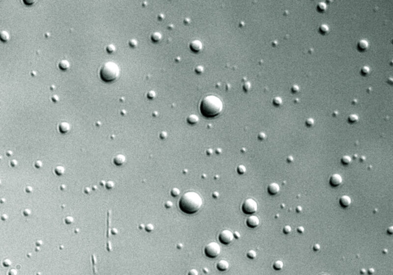 Phase-separated dense liquid droplets formed from histone H1 C-terminal tail/DNA complexes, viewed under a microscope.