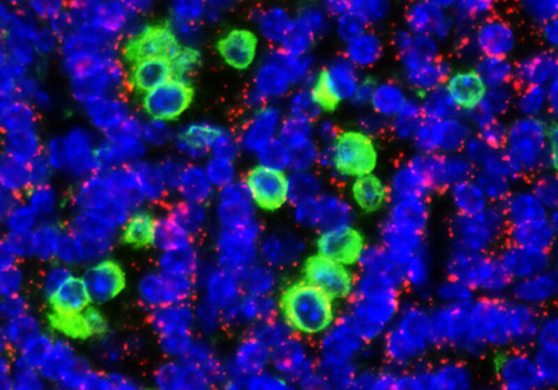 Lung tumour cells expressing switchable Myc, surrounded by macrophages