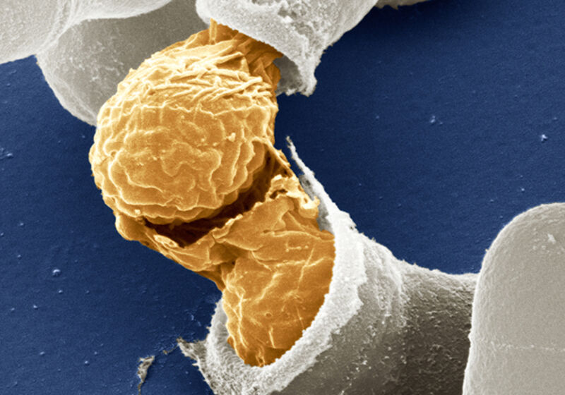 Scanning electron microscope image of sporulating fission yeast cells (Schizosaccharomyces pombe).