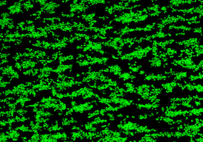 Platelet thrombi formed on collagen without MMP-13