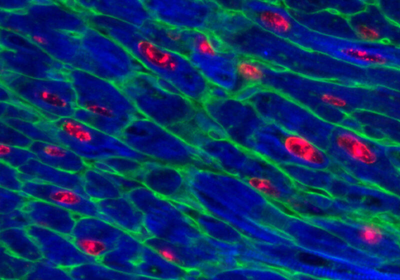 Adult mouse heart 48 hours after activation of Myc together with Ccnt1 expression.