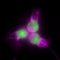 The choanoflagellate Salpingoeca rosetta expressing fluorescent proteins illuminating the cell body (green) and the plasma membrane (magenta)