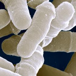 Scanning electron micrograph of an S.pombe culture