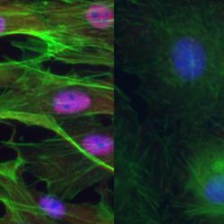 RBPMS is a master regulator of splicing in smooth muscle cells