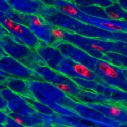 Adult mouse heart 48 hours after activation of Myc together with Ccnt1 expression.