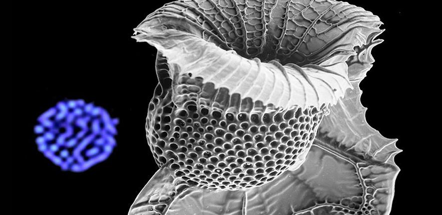 Dinoflagellates compact DNA without histones Dinoflagellates compact DNA without histones