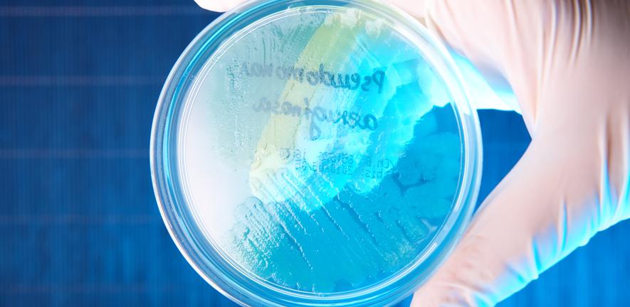 Pseudomonas aeruginosa culture. Pseudomonas aeruginosa culture.