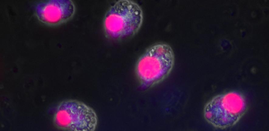 Immunofluorescence microscopy of Amphidinium carterae showing the expression of an artificially introduced gene. Immunofluorescence microscopy of Amphidinium carterae showing the expression of an artificially introduced gene.