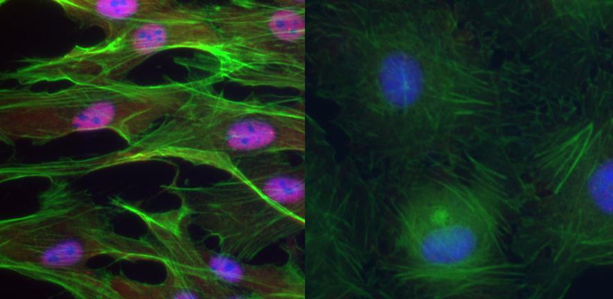 RBPMS is a master regulator of splicing in smooth muscle cells RBPMS is a master regulator of splicing in smooth muscle cells