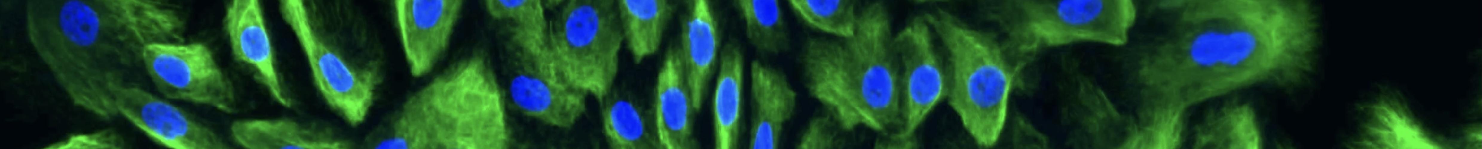 Human milk cells grown in culture. Image: Alecia-Jane Twigger Human milk cells grown in culture. Image: Alecia-Jane Twigger