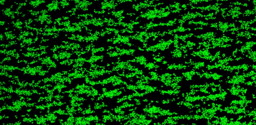 Platelet thrombi formed on collagen without MMP-13