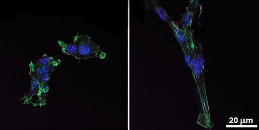 Normal and genetically engineered pancreatic cancer cells Normal and genetically engineered pancreatic cancer cells