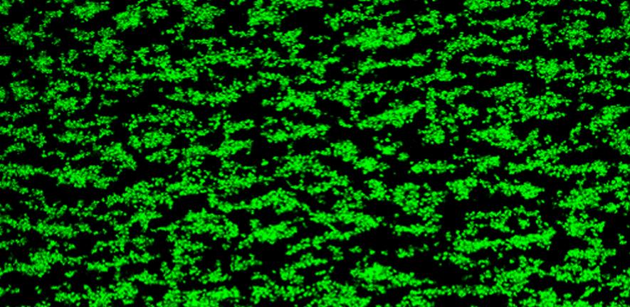 Platelet thrombi formed on collagen without MMP-13 Platelet thrombi formed on collagen without MMP-13
