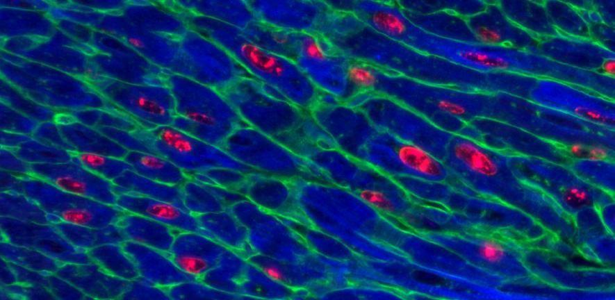 Adult mouse heart 48 hours after activation of Myc together with Ccnt1 expression. Adult mouse heart 48 hours after activation of Myc together with Ccnt1 expression.