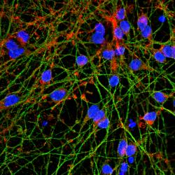 Differentiated human neurons labelled in green with synapses in red and nuclei in blue.