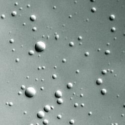 Phase-separated dense liquid droplets formed from histone H1 C-terminal tail/DNA complexes, viewed under a microscope.