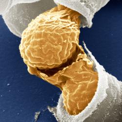 Scanning electron microscope image of sporulating fission yeast cells (Schizosaccharomyces pombe).