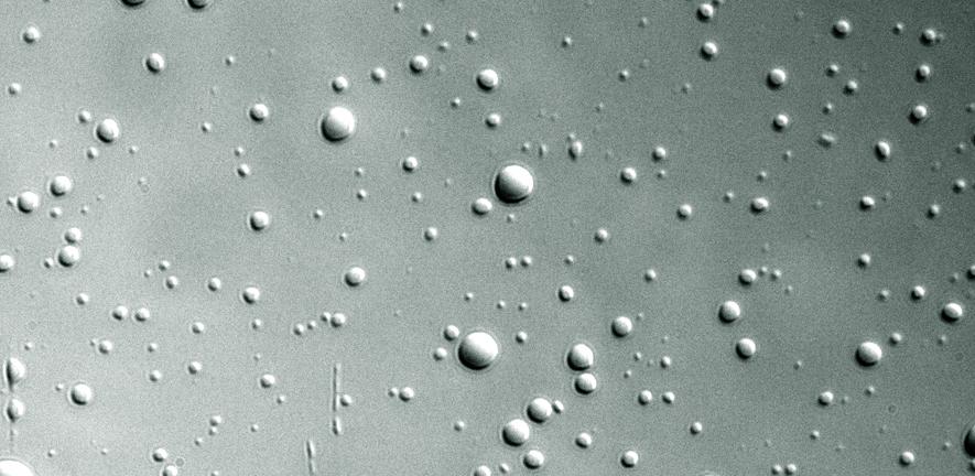 Phase-separated dense liquid droplets formed from histone H1 C-terminal tail/DNA complexes, viewed under a microscope.