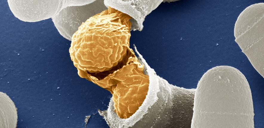 Scanning electron microscope image of sporulating fission yeast cells (Schizosaccharomyces pombe).
